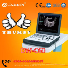 Escáner ultrasónico DW-C60, mini portátil de bajo precio nuevo ultrasonido portátil completo digital